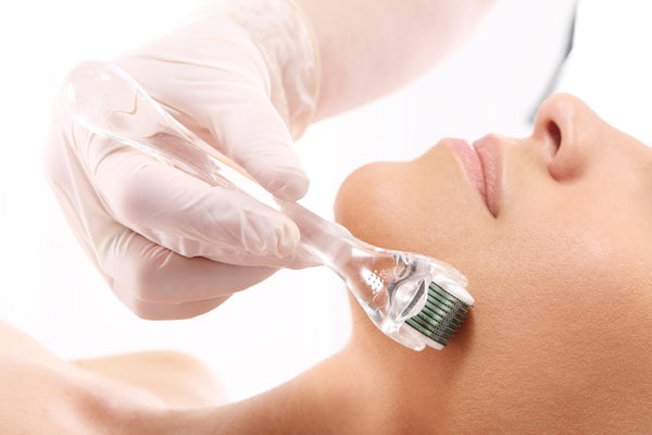 Microneedling full face and neck